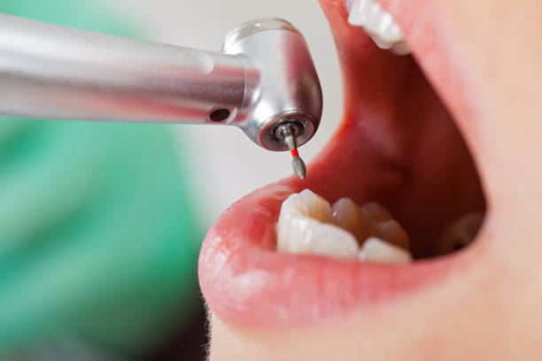 Best Weekend Emergency Dentist in Boley, OK
